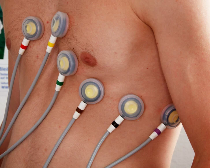 EKG-Saugelektroden zur Ableitung an der Brustwand