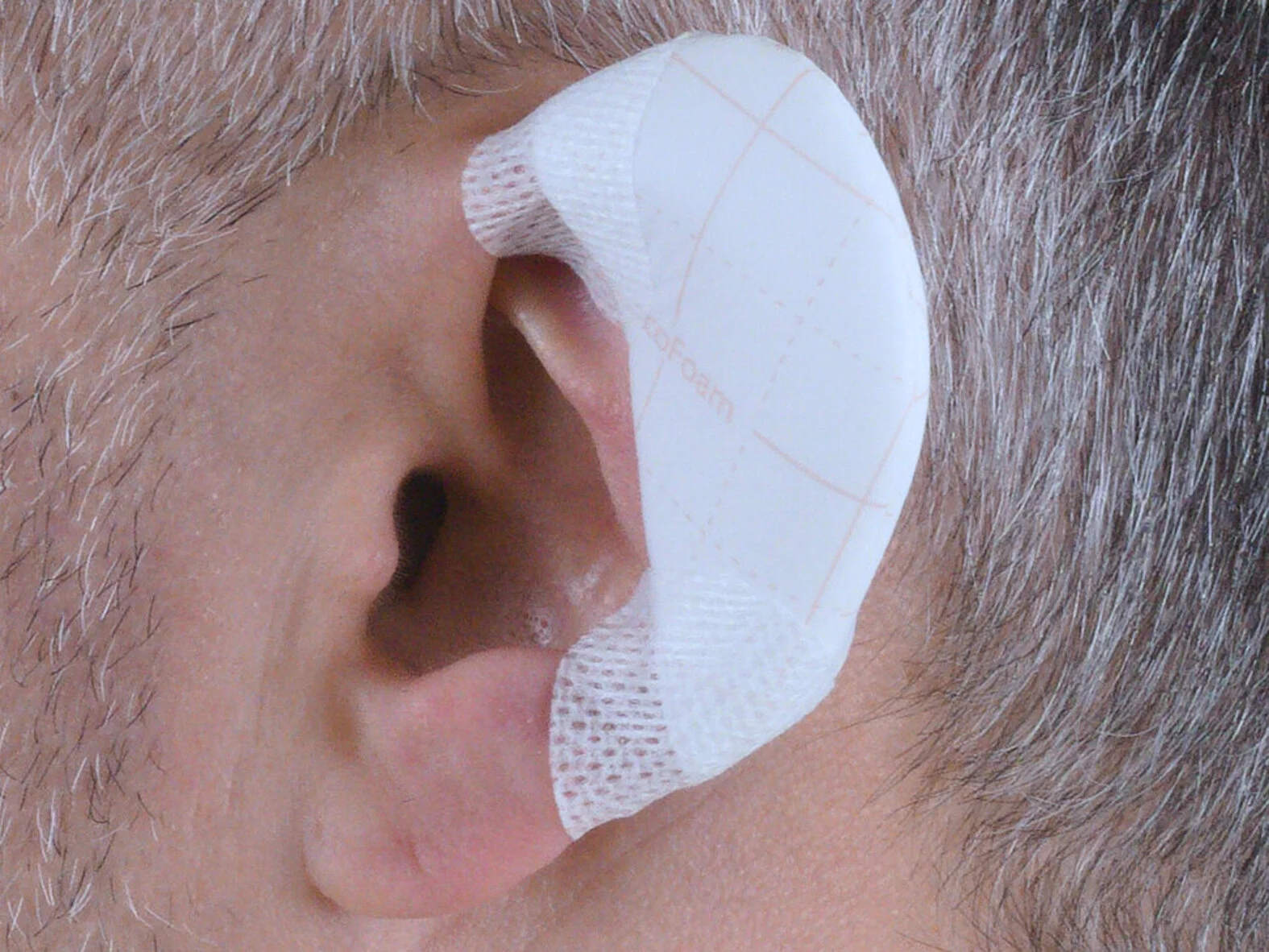 Verband am Ohr, zugeschnittene Zehenkappe