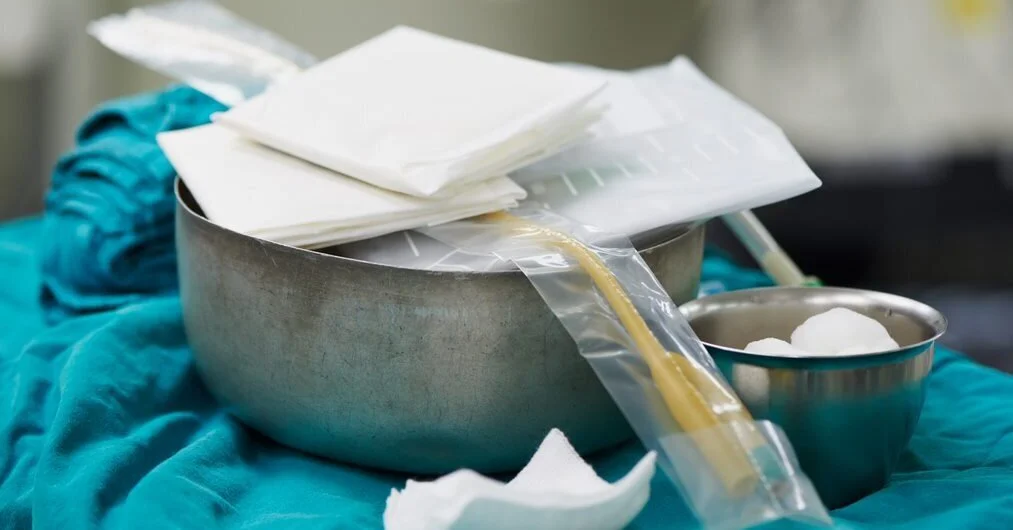Drainagen (Medizin) Definition, Arten,