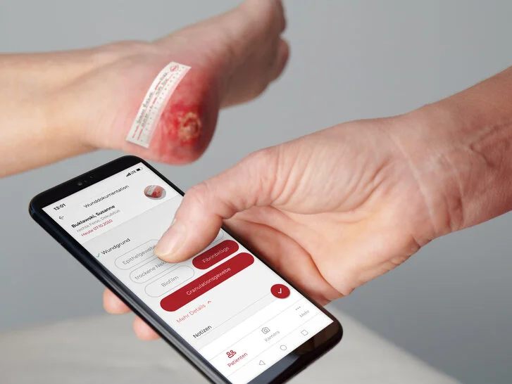 Wunde anlegen in App Wunde anlegen in App