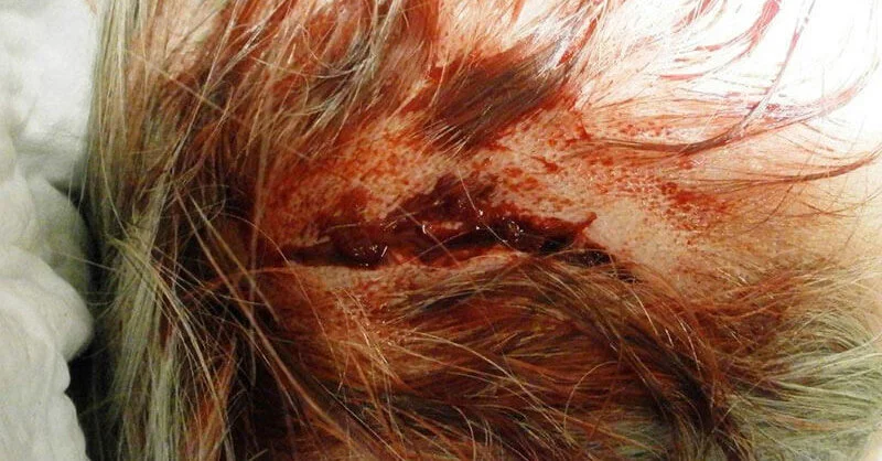 Wie lange muss eine geklebte Wunde zum heilen?