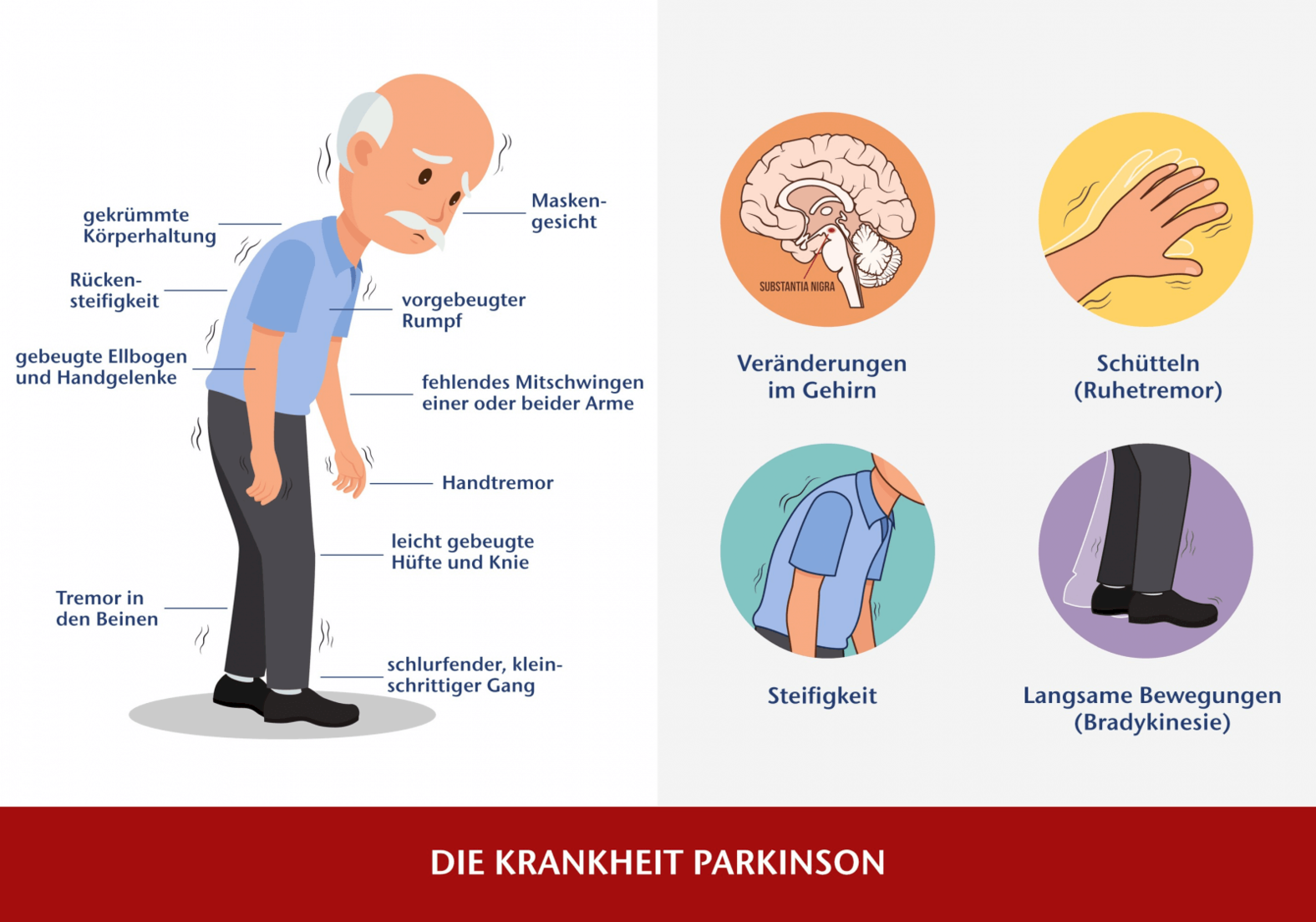 Parkinson Grafik mit Symptomen