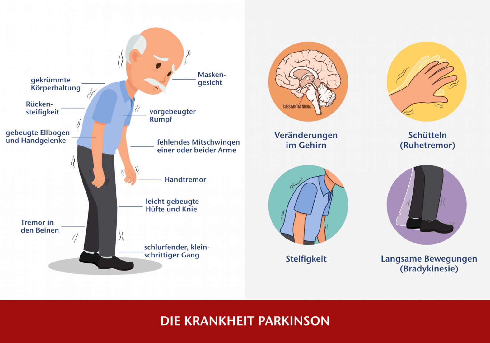 Kann Man Parkinson Im Blut Feststellen www.draco.de