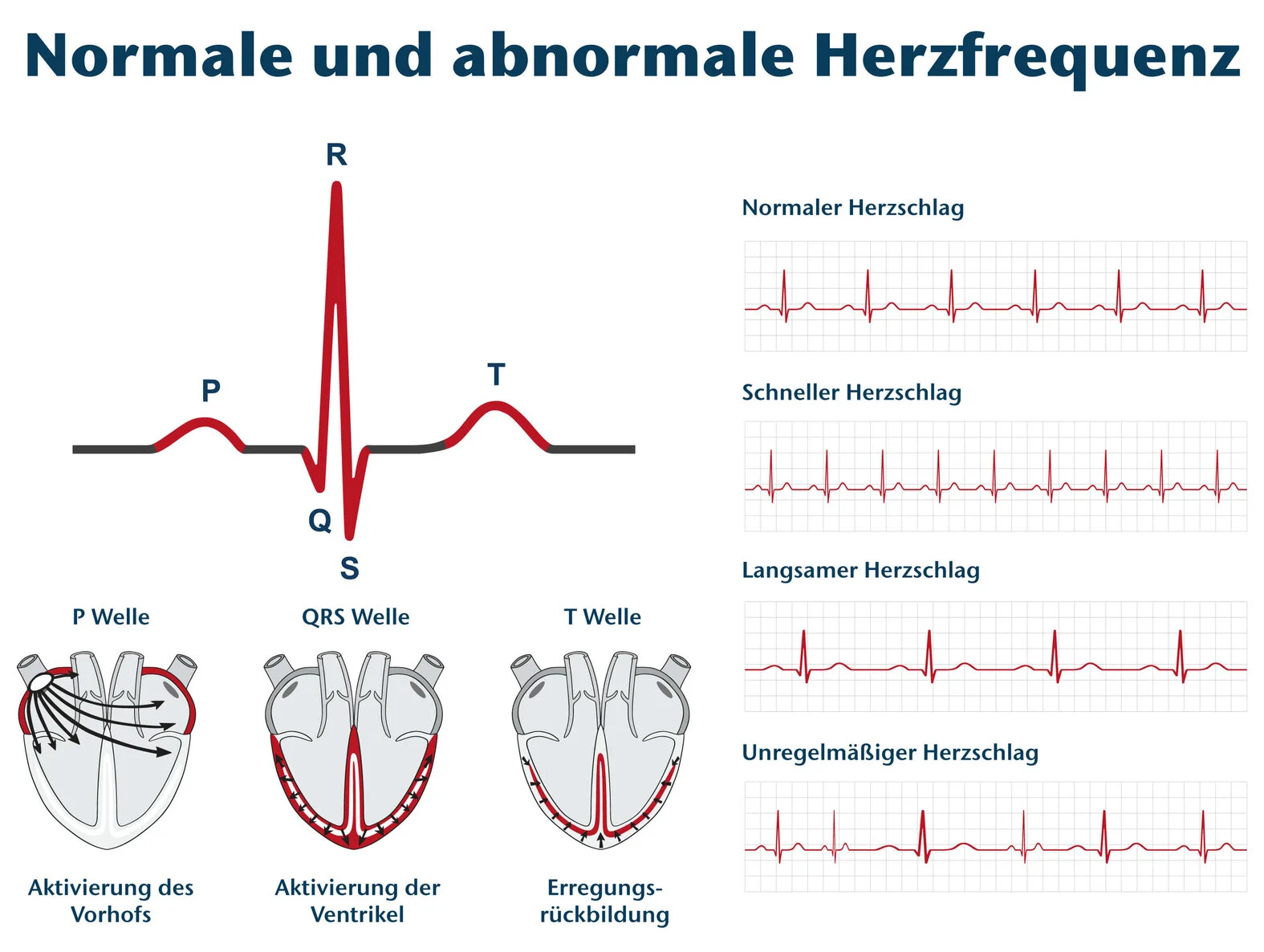 Herzfrequenz, EKG, Illustration der P-, QRS- und T-Wellen