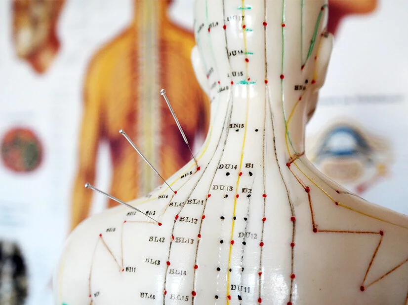 Schmerztherapie, Akupunktur Modell mit Meridianen und Akupunkturnadeln