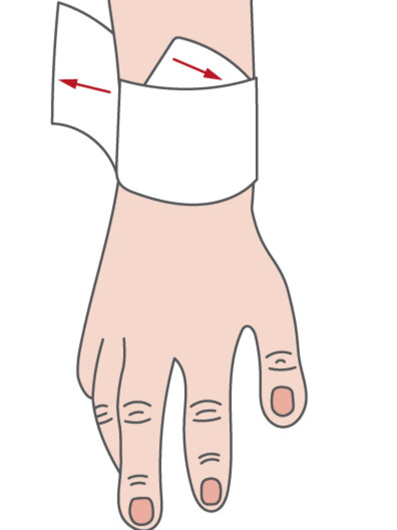Stützverband, Wundverband anlegen Verbände und Verbandstechniken