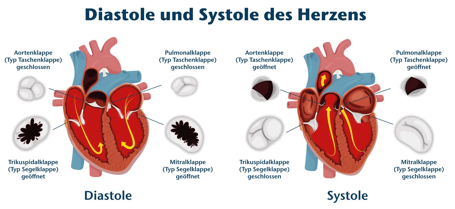 Systole und Diastole des Herzens, Herzklappen, schematische Darstellung