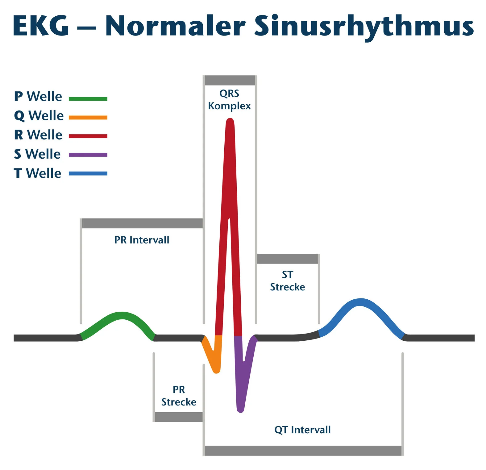 EKG, Sinusrhythmus, Darstellung der EKG-Welle