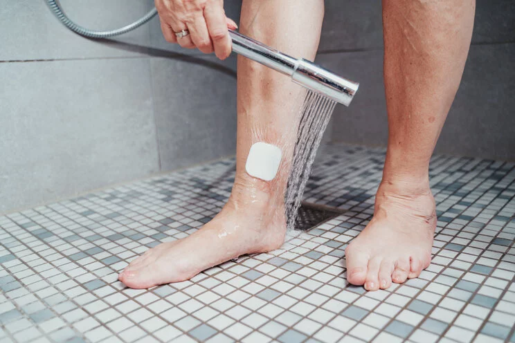 Duschen mit Wunde? – Das sollten Sie zur Körperpflege wissen