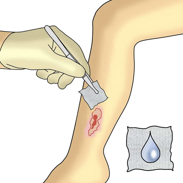 Dracosuper Absorber Verbandwechsel Schritt 1