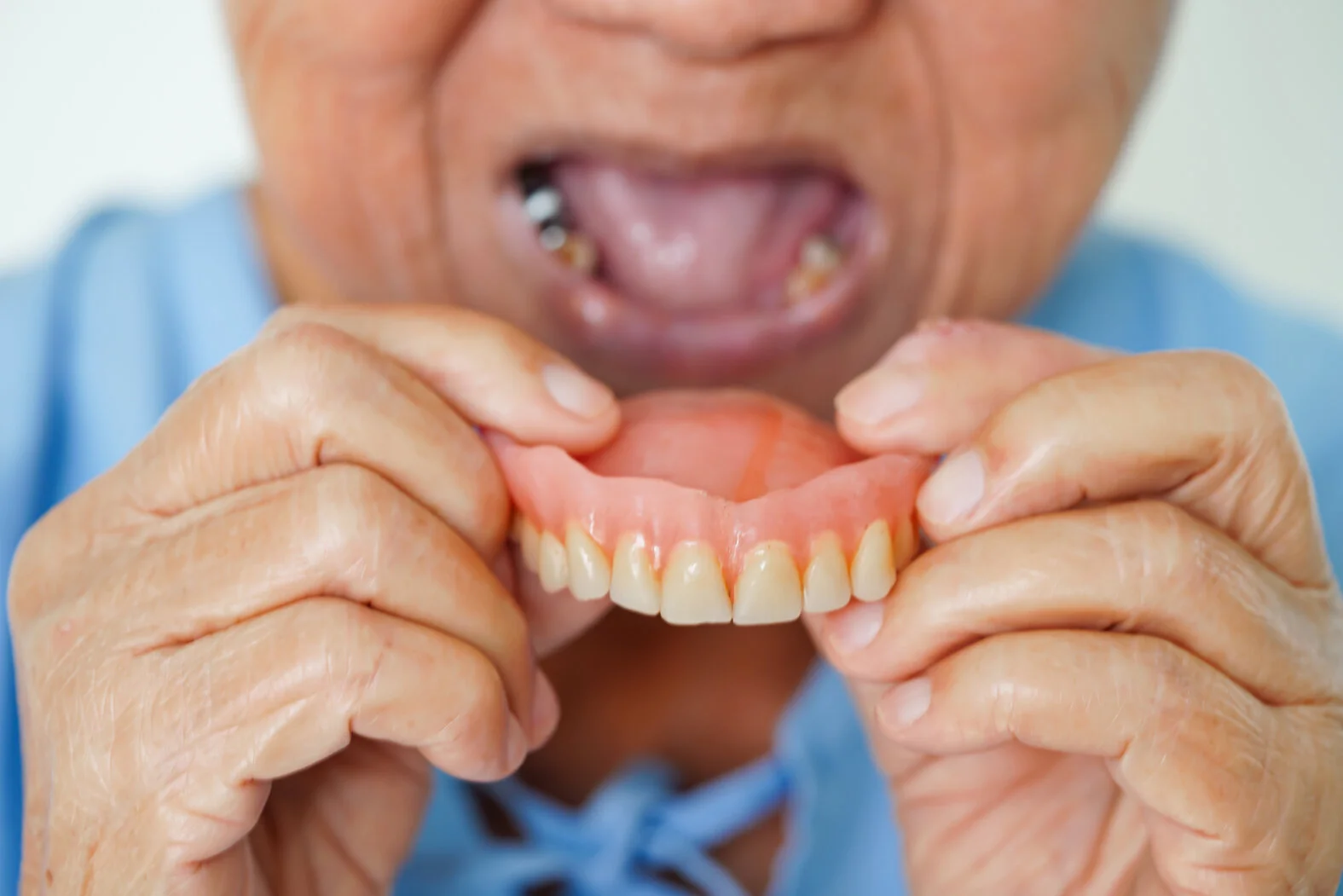 Mundgesundheit: Einsetzen einer Zahnprothese