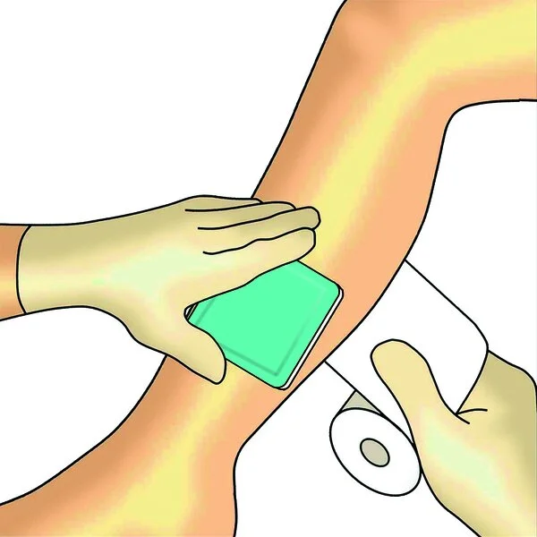 Dracosuper Absorber Verbandwechsel Schritt 5